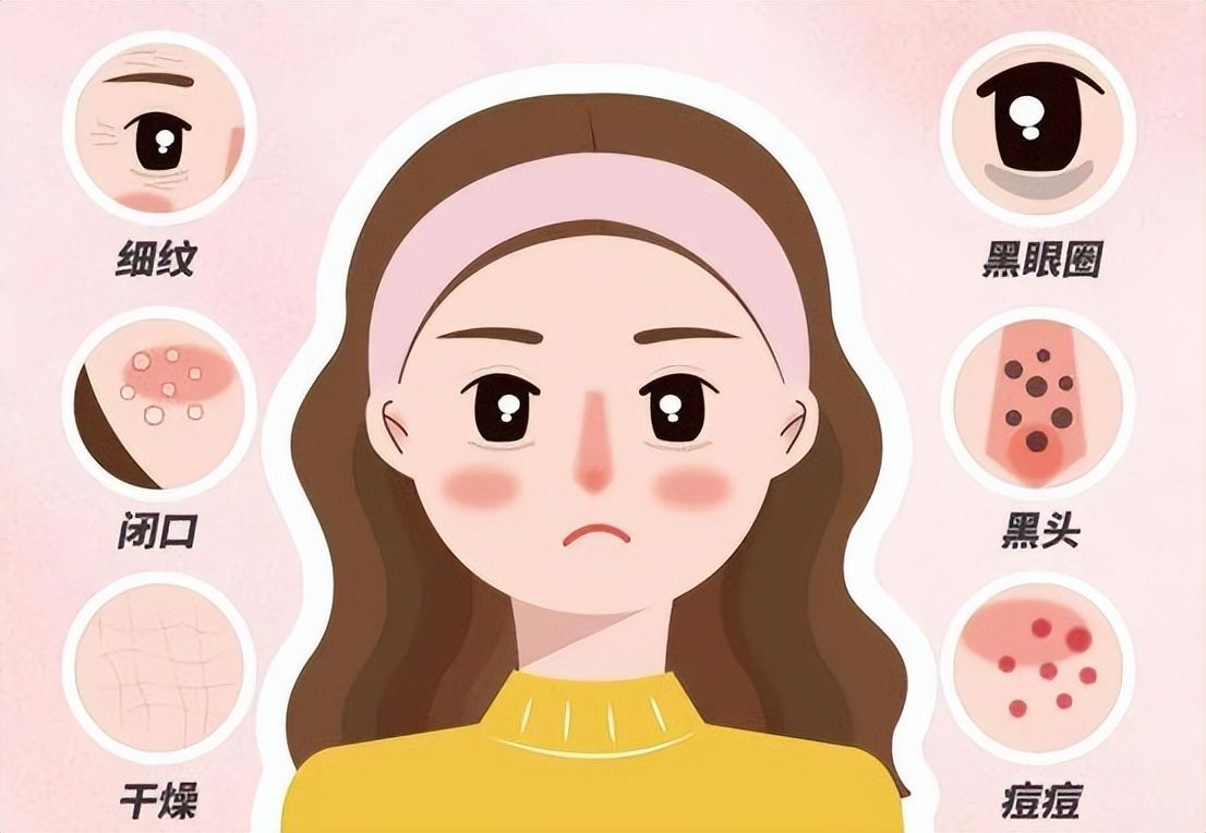 黑頭毛孔粗大油皮怎么辦_毛孔粗大黑頭多皮膚油應該怎么辦_黑頭毛孔粗大油膩用什么產品好